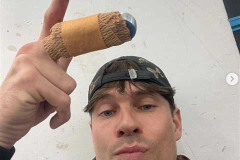 Dancing On Ice’s Joey Essex ‘lucky to have his finger’ after slicing it open in horror smash