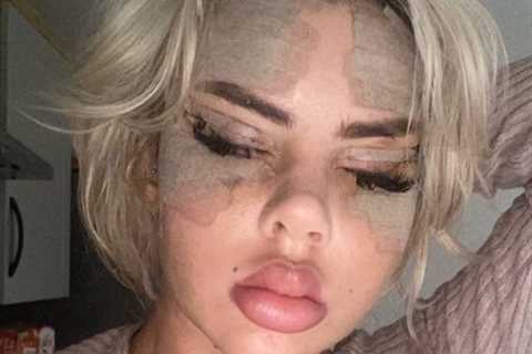 Love Island’s Hannah Elizabeth shows off new face after shock new surgery