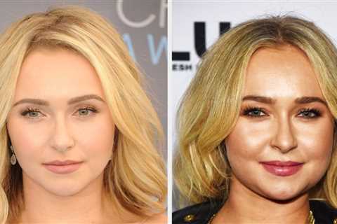 Hayden Panettiere Revealed That She Experienced Liver Failure While Battling Addiction