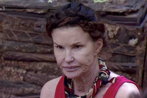 Inside Janice Dickinson’s ‘traumatic’ I’m A Celeb accident that left her ‘scarred & bandaged..