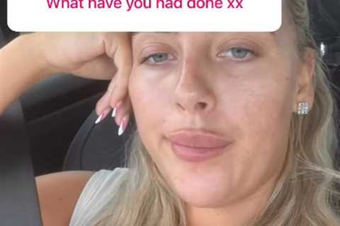 Love Island winner Jess Harding reveals exactly what she’s had done to her face including lip and..