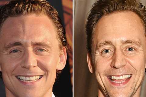 Tom Hiddleston -- Good Genes Or Good Docs?!