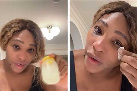 Serena Williams Says Her Breast Milk Helped Heal Her Facial Sunburns