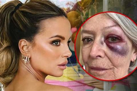 Kate Beckinsale Sparks Concern After Posting Photo of Mom with Bruised Eye