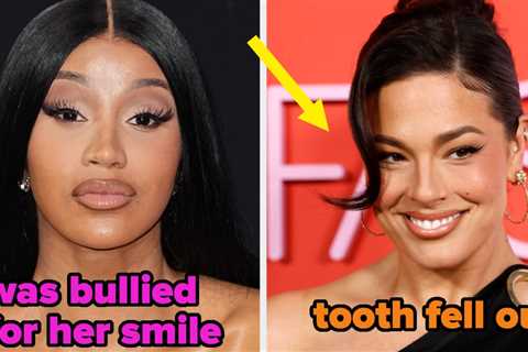 It Feels Like Everyone Is Getting Veneers, So Here Are 20 Celebs Who Have Them