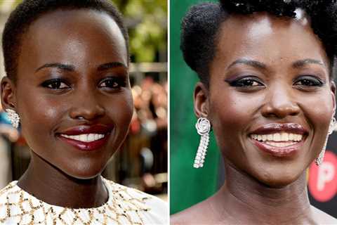 Lupita Nyong'o -- Good Genes or Good Docs?!