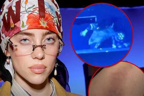 Billie Eilish Takes Dramatic Tumble Onstage, Shows Off Massive Bruise