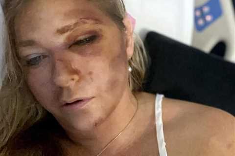 School Bus 'Crash' Mess: Parents Blast Virginia Giuffre's Four Days to Live Claims as Total BS