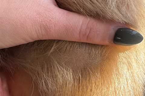 Love Island Star Opens Up About Alopecia Return