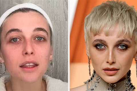 A Stranger In A Hair Salon Diagnosed Emma Chamberlain With PCOS After Noticing This Specific Thing..
