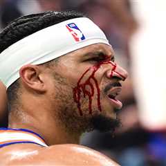 Knicks’ Josh Hart bloodied after getting hit with elbow in scary moment