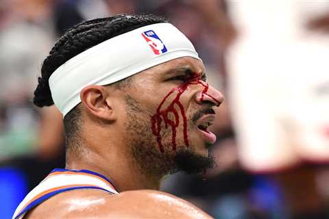 Knicks’ Josh Hart bloodied after getting hit with elbow in scary moment