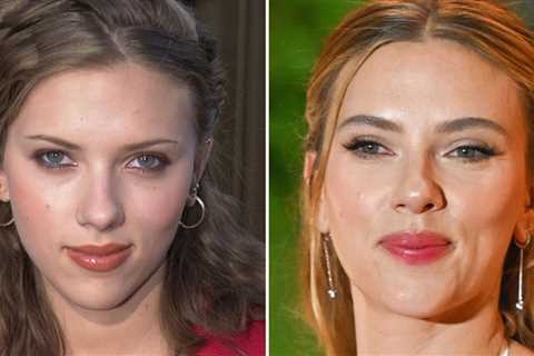 Scarlett Johansson -- Good Genes or Good Docs?!