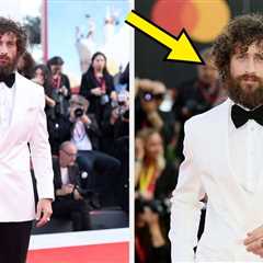 People Are Dragging Aaron Taylor-Johnson After He Was Barely Recognizable At The Venice Film..