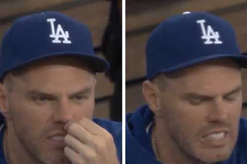 Freddie Freeman Caught On Dodgers Broadcast Ripping Out Nose Hair