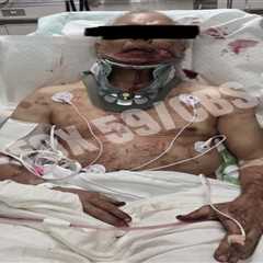 Truck driver allegedly bashed by Mark Sanchez pictured in hospital with bloody injuries after..