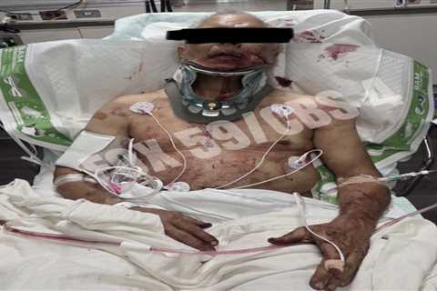 Truck driver allegedly bashed by Mark Sanchez pictured in hospital with bloody injuries after..