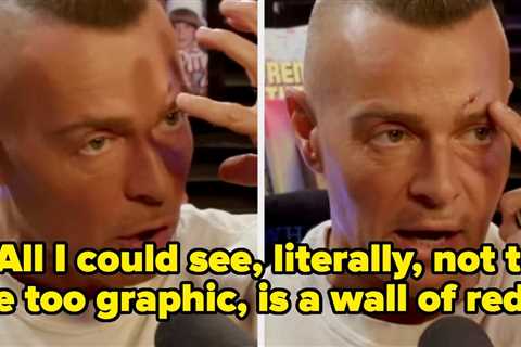 '90s Star Joey Lawrence Revealed Why His Face Is All Bruised And Banged Up, And It's Pretty Wild