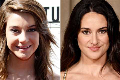 Shailene Woodley -- Good Genes or Good Docs?!