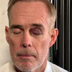 Joe Buck reveals black eye hidden by ESPN makeup artist after Seahawks-49ers game