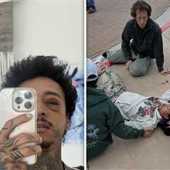 Nyjah Huston Fractures Skull, Eye Socket After Failed Skateboard Trick