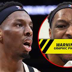 Hawks' Onyeka Okongwu Elbowed In Face By Jaylen Brown, Teeth Knocked Out