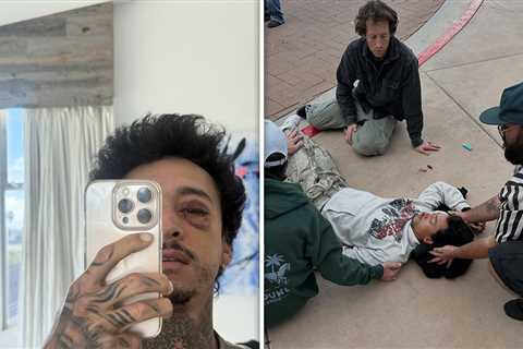Nyjah Huston Fractures Skull, Eye Socket After Failed Skateboard Trick