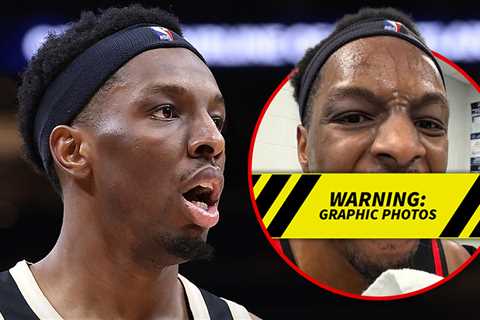 Hawks' Onyeka Okongwu Elbowed In Face By Jaylen Brown, Teeth Knocked Out