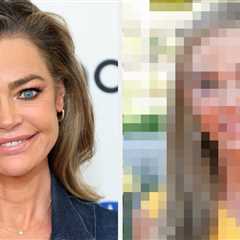 Denise Richards Got A Facelift, And The Before-And-After Is Wild