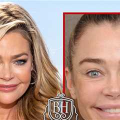 Denise Richards' Before-and-After Pics Are Giving Her Surgeon's Business a Lift