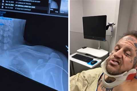Jelly Roll Was at Grammys With a Broken Collarbone From ATV Crash, Bunnie Posts Vid