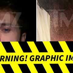 Dakota Mortensen Alleged Injuries From Taylor Frankie Paul Altercations, See Pics