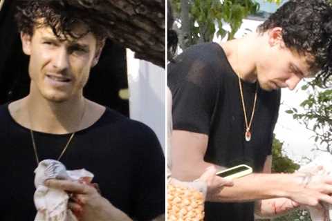 Shawn Mendes Suffers Bloody Hand Injury, Pics Show Wounded Fingers