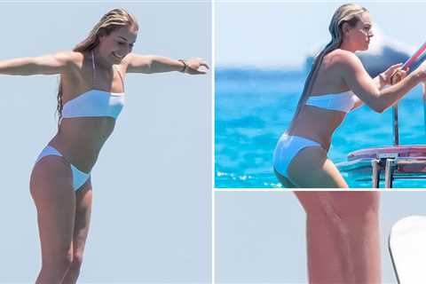 Lindsey Vonn Shows Off Surgery Scars In Bikini