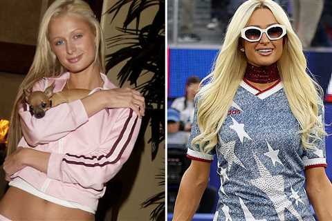 Paris Hilton Then & Now ... Good Genes or Good Docs, Hot Shots