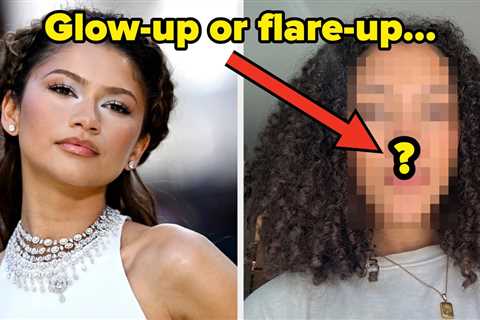 As Someone With Sensitive Skin, I Tried The Charlotte Tilbury Moisturizer That Zendaya Used At “The ..