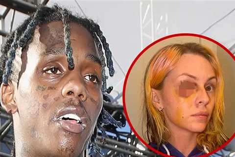 Famous Dex Allegedly Gave Reality Star Ex a Black Eye, See Shocking Photos