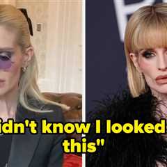 “I Didn’t Know I Looked Like This”: Kelly Osbourne Has Recalled The Moment She Realized How Unwell..