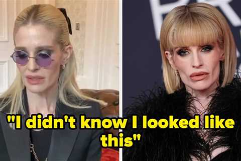 “I Didn’t Know I Looked Like This”: Kelly Osbourne Has Recalled The Moment She Realized How Unwell..